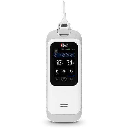 Masimo Rad-G handheld pulse oximeter with accurate SpO2 and pulse rate monitoring in rugged design